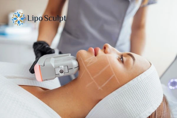 HIFU vs Botulinum Toxin: Understanding the Differences 1 HIFU vs Botox Witney What is the best option for you?