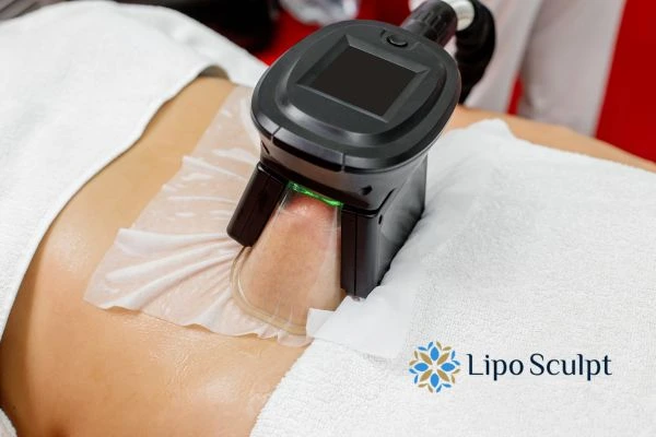 Does Fat Freezing at Home Work? DIY Devices vs Professional Cryolipolysis 1 How is professional cryolipolysis different Witney?