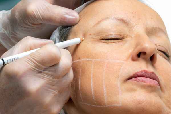 CryoPen: 5 Skin Concerns It May Be Used to Treat 4 What should you ask before having CryoPen treatment Witney?