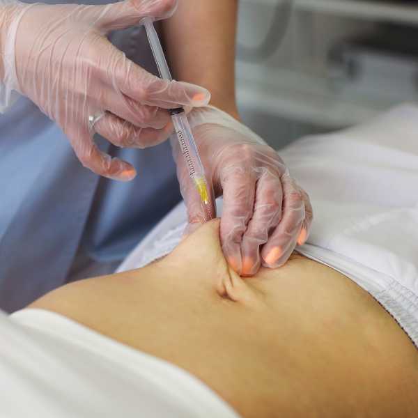 Aqualyx for Muffin Tops: What to Know Before Fat-Dissolving Injections 4 Aqualyx for Muffin Tops: What to Know Before Fat-Dissolving Injections