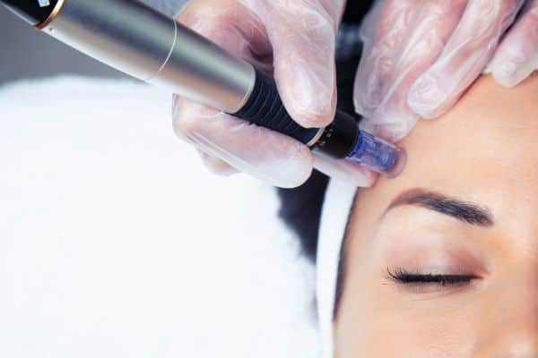 Explaining Total Skin Tightening Treatment and What to Expect 2 What Skin Concerns Can Total Skin Tightening Treatment Help With Witney?